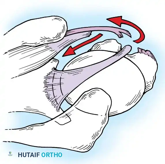Hutaifortho's Orthopaedic Diagram