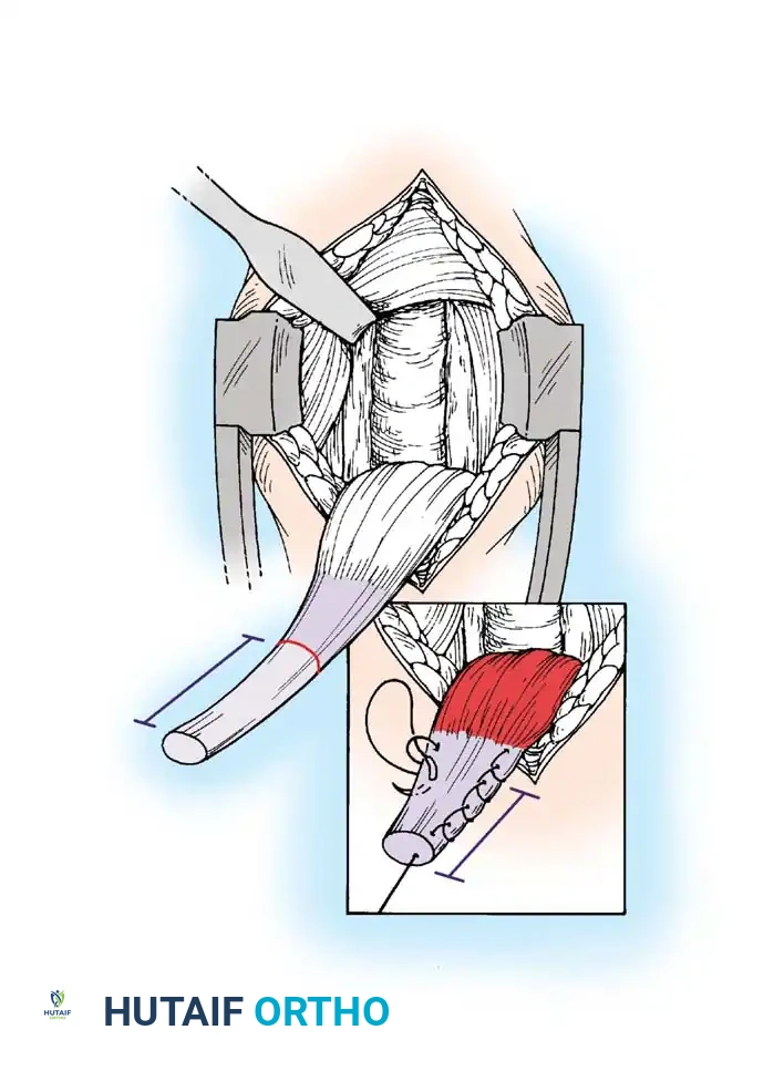 Hutaifortho's Orthopaedic Diagram
