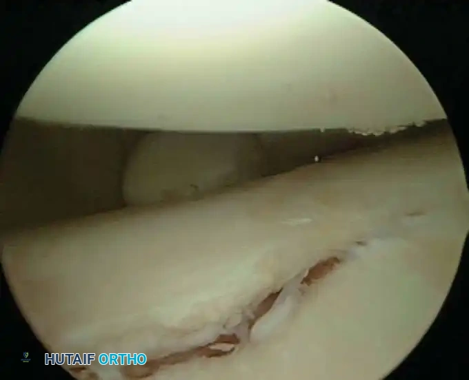 Hutaifortho's Orthopaedic Diagram