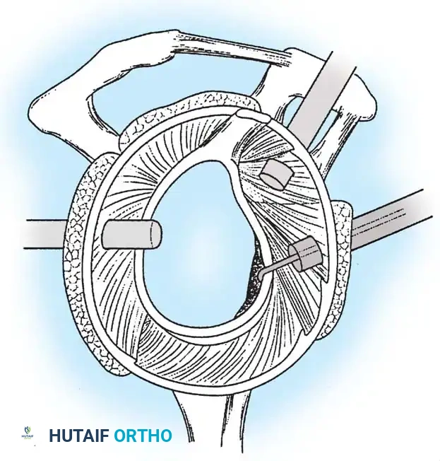 Hutaifortho's Orthopaedic Diagram