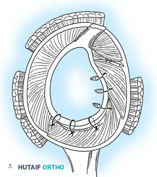 Hutaifortho's Orthopaedic Diagram