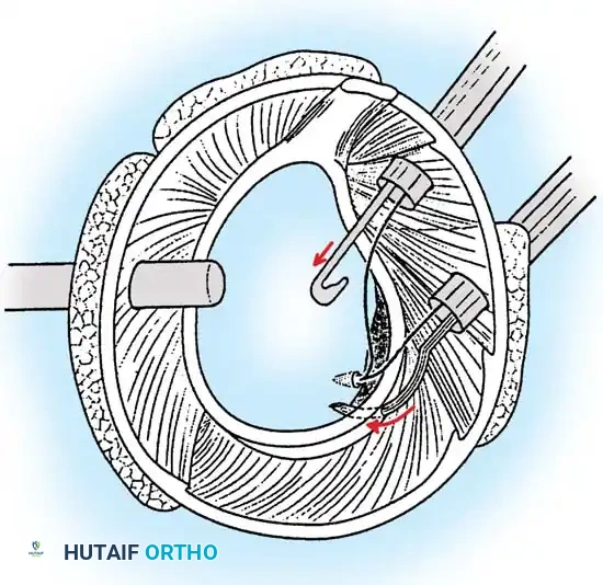 Hutaifortho's Orthopaedic Diagram