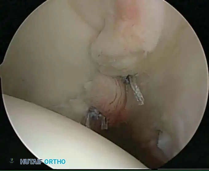 Hutaifortho's Orthopaedic Diagram