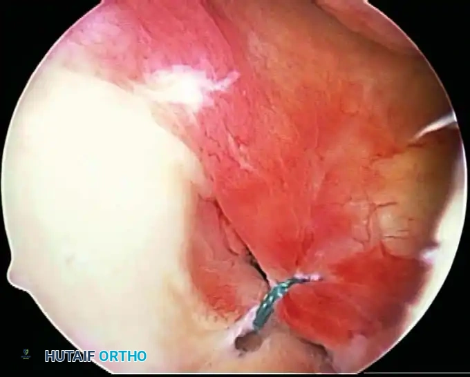 Hutaifortho's Orthopaedic Diagram