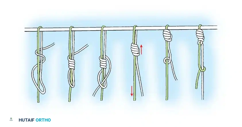 Hutaifortho's Orthopaedic Diagram