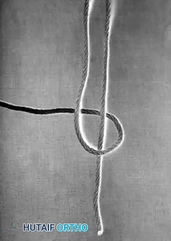 Hutaifortho's Orthopaedic Diagram