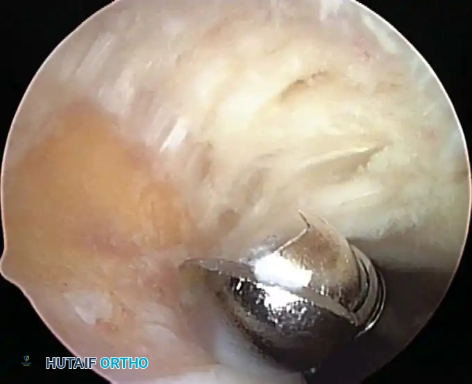 Hutaifortho's Orthopaedic Diagram