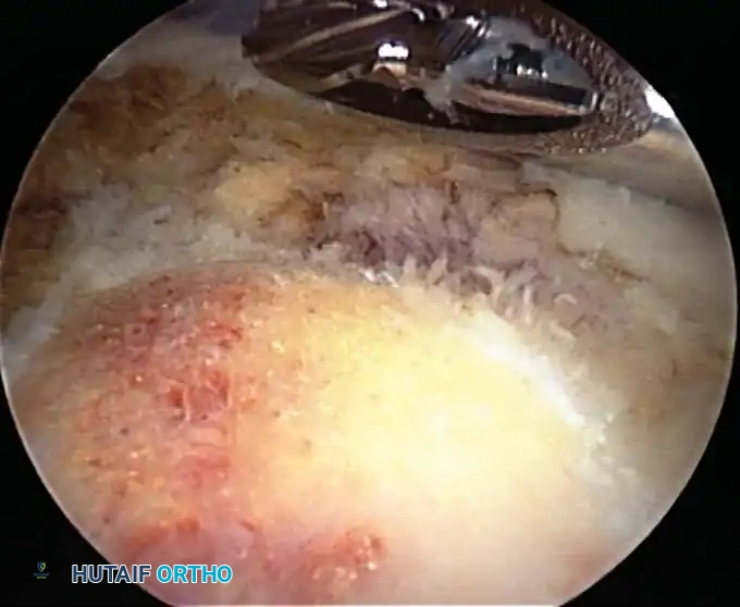 Hutaifortho's Orthopaedic Diagram