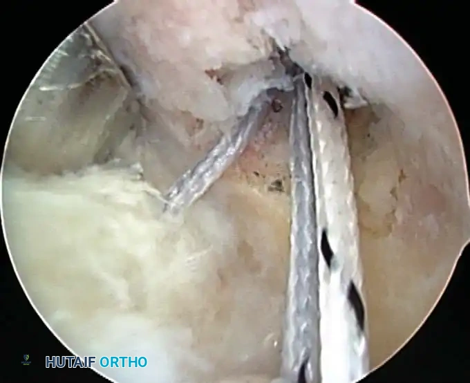 Hutaifortho's Orthopaedic Diagram
