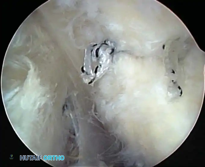 Hutaifortho's Orthopaedic Diagram