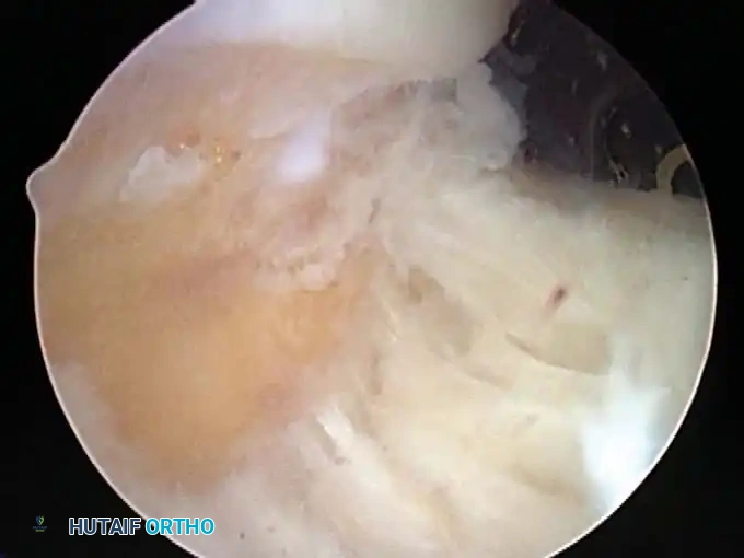 Hutaifortho's Orthopaedic Diagram