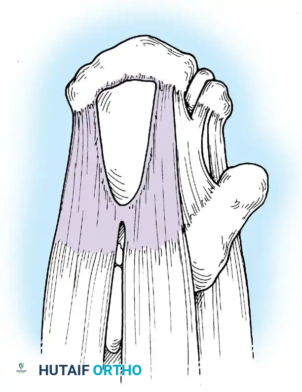 Hutaifortho's Orthopaedic Diagram