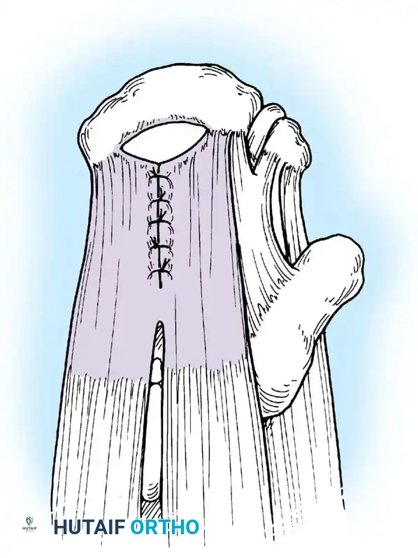 Hutaifortho's Orthopaedic Diagram