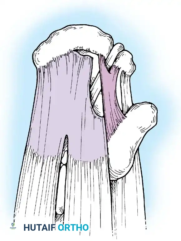 Hutaifortho's Orthopaedic Diagram