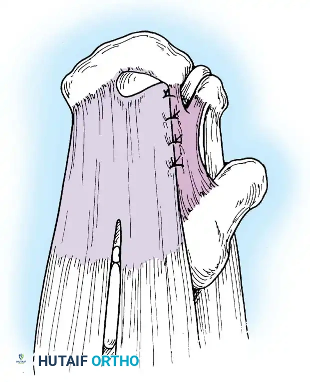 Hutaifortho's Orthopaedic Diagram