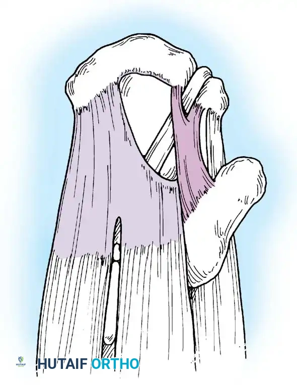 Hutaifortho's Orthopaedic Diagram