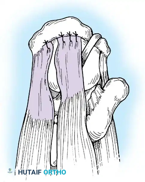 Hutaifortho's Orthopaedic Diagram