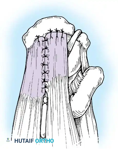 Hutaifortho's Orthopaedic Diagram