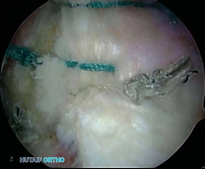 Hutaifortho's Orthopaedic Diagram
