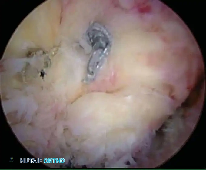 Hutaifortho's Orthopaedic Diagram