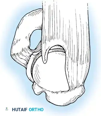 Hutaifortho's Orthopaedic Diagram