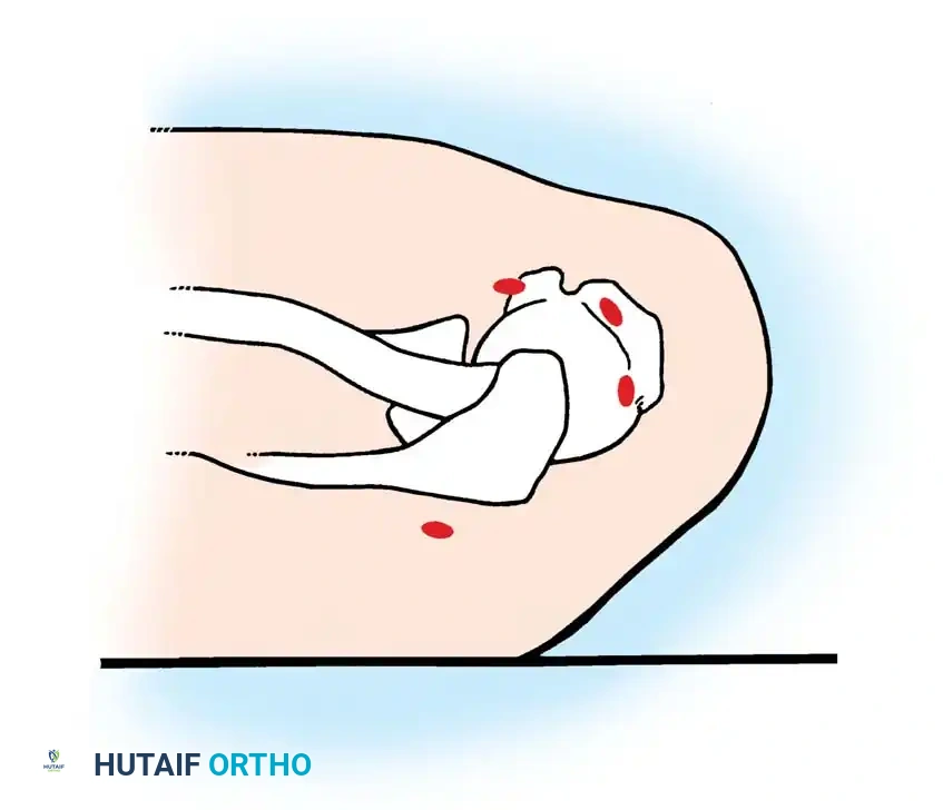 Hutaifortho's Orthopaedic Diagram