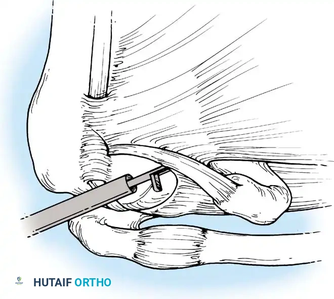 Hutaifortho's Orthopaedic Diagram