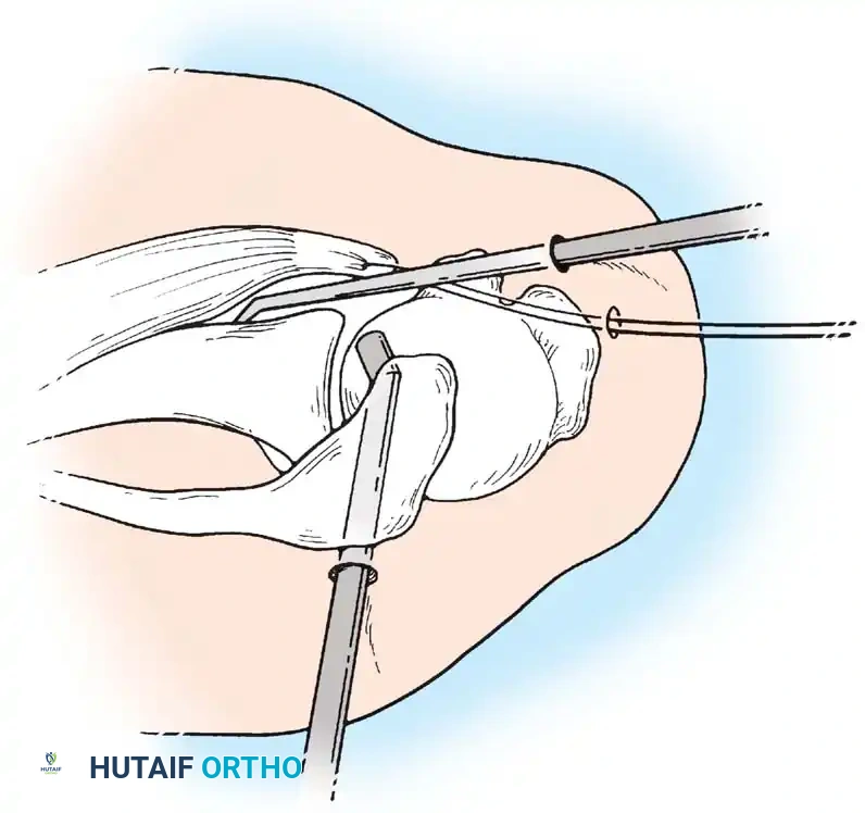 Hutaifortho's Orthopaedic Diagram