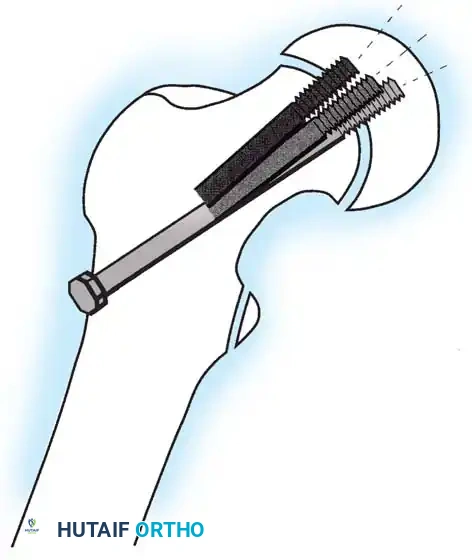 Hutaifortho's Orthopaedic Diagram