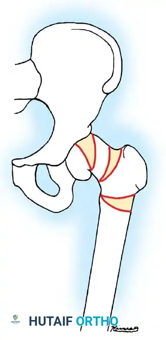 Hutaifortho's Orthopaedic Diagram
