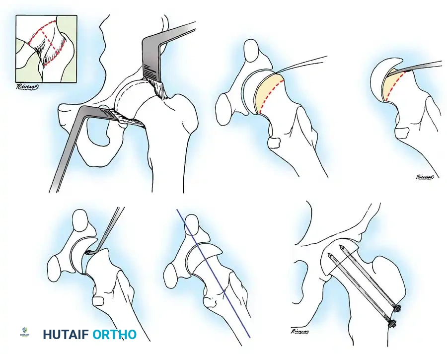 Hutaifortho's Orthopaedic Diagram
