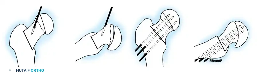 Hutaifortho's Orthopaedic Diagram