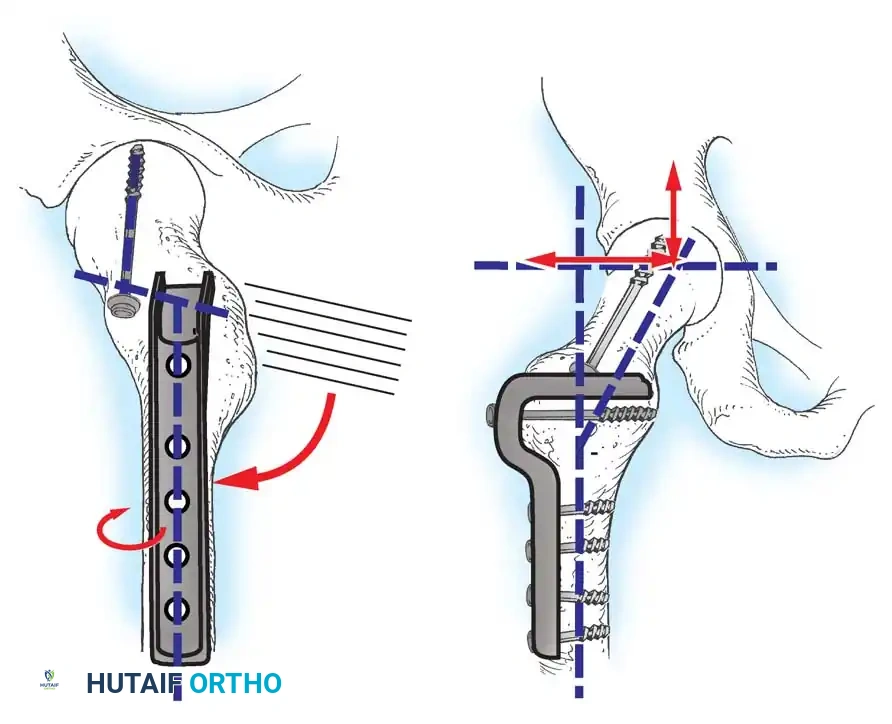 Hutaifortho's Orthopaedic Diagram