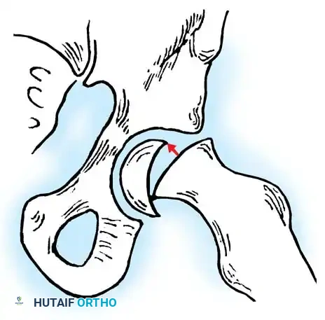 Hutaifortho's Orthopaedic Diagram