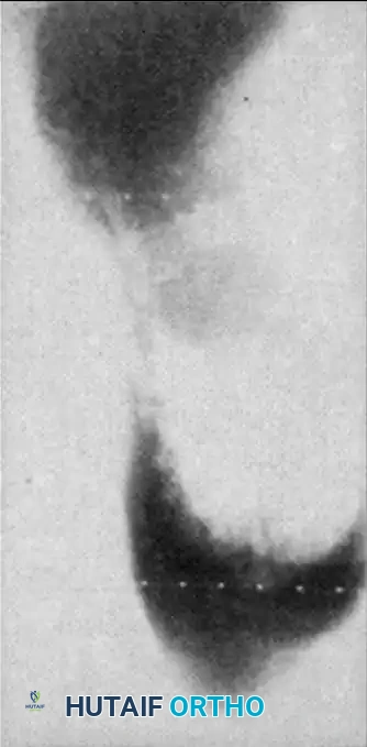 Hutaifortho's Orthopaedic Diagram