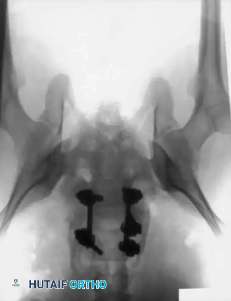 Hutaifortho's Orthopaedic Diagram