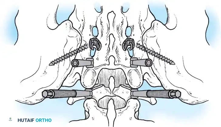 Hutaifortho's Orthopaedic Diagram