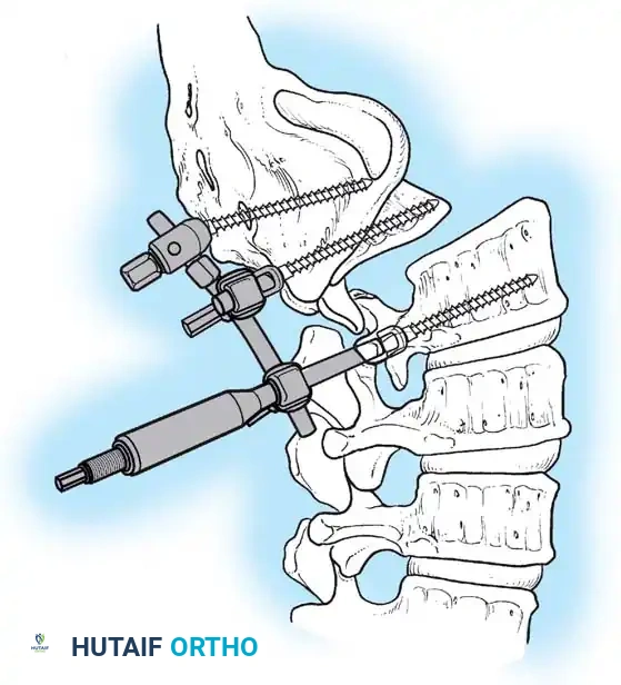 Hutaifortho's Orthopaedic Diagram