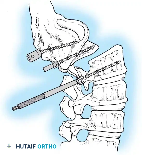 Hutaifortho's Orthopaedic Diagram