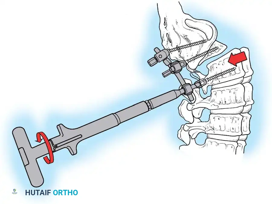 Hutaifortho's Orthopaedic Diagram