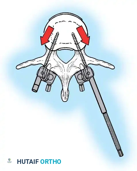 Hutaifortho's Orthopaedic Diagram