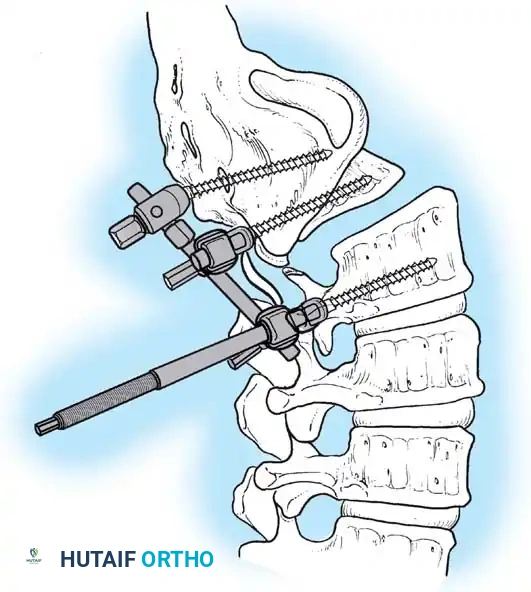 Hutaifortho's Orthopaedic Diagram