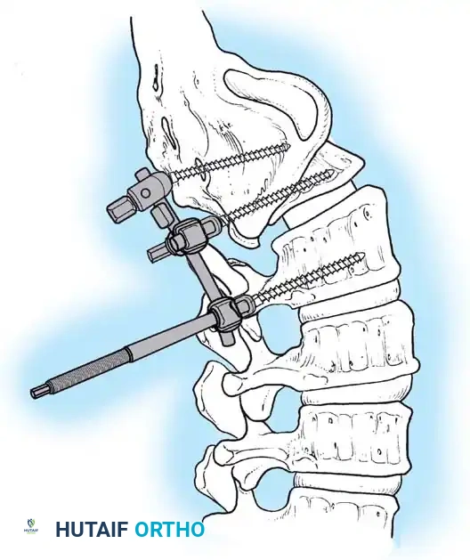 Hutaifortho's Orthopaedic Diagram