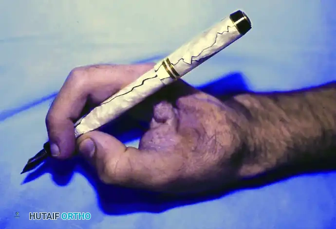 SQUAMOUS CELL CARCINOMA Surgical Diagram