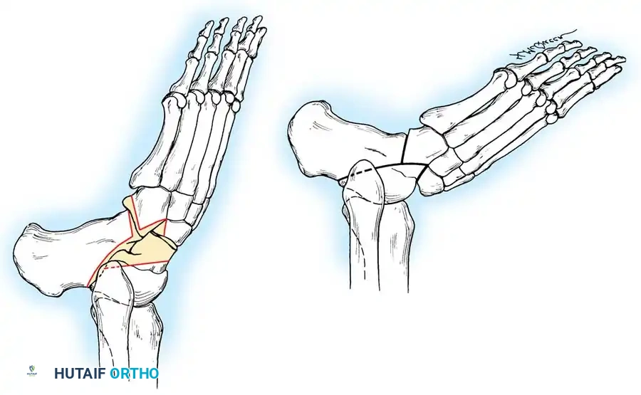 SUMMARY Surgical Diagram