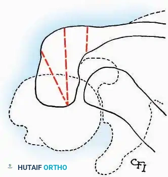 Hutaifortho's Orthopaedic Diagram