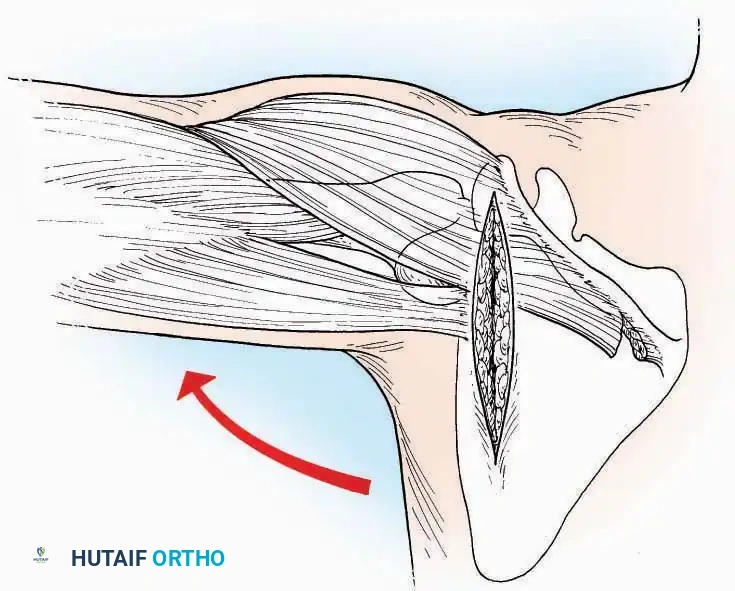 Hutaifortho's Orthopaedic Diagram