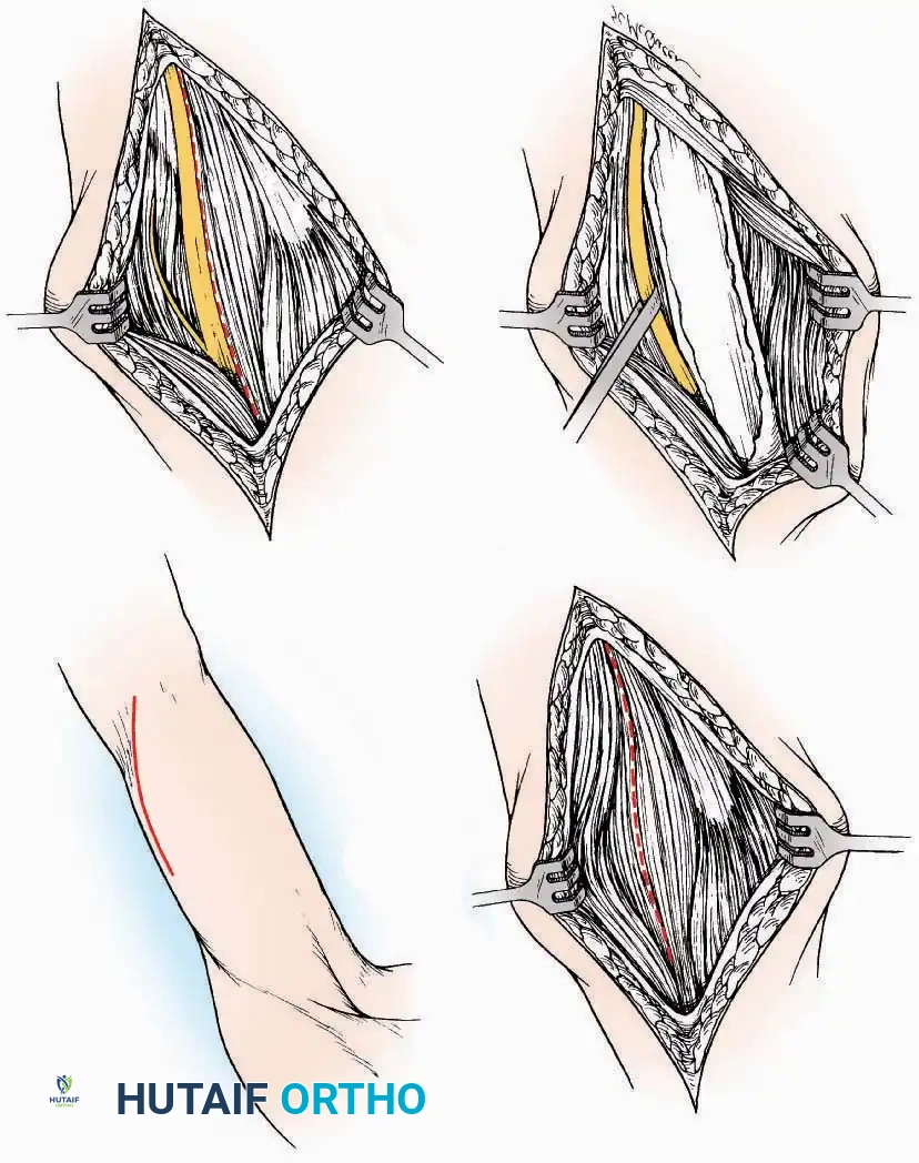 Hutaifortho's Orthopaedic Diagram