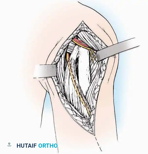 Hutaifortho's Orthopaedic Diagram