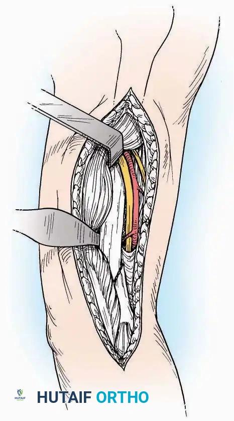 Hutaifortho's Orthopaedic Diagram